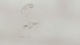 After 打痕リペア後拡大画像